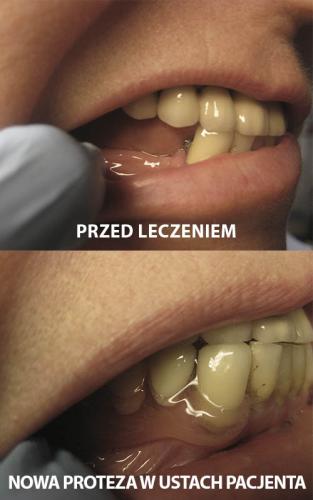 PACJENTKA 6 - 45 LAT